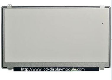 착용할 수 있는 스마트 워치를 위한 MCU SPI 인터페이스 IPS 케케묵은 TFT 디스플레이 모듈